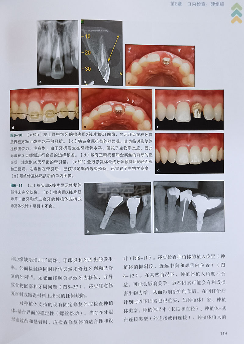 牙齒修復(fù)前沿技術(shù)觀點(diǎn)論述