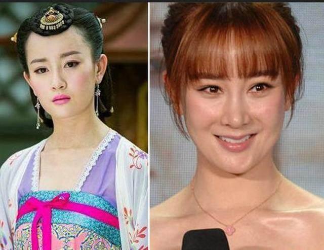 坦然面對整容，女明星的美麗新篇章之旅