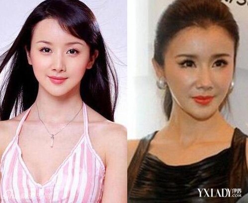 探秘明星整容的秘密，神秘美容小店的魅力所在！